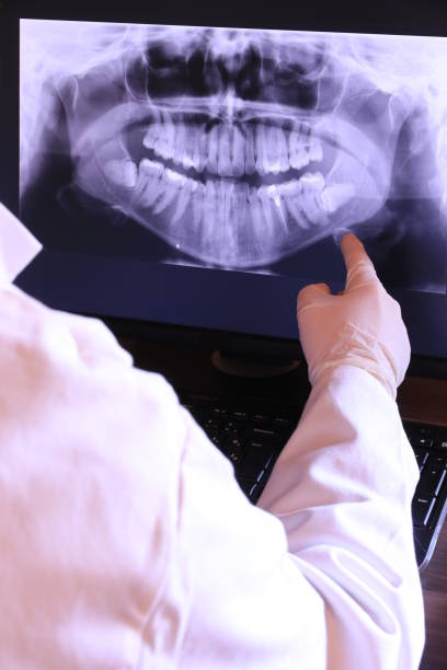 Best Dental Abscess Treatment in Frackville, PA