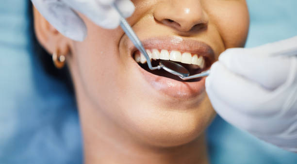 Best Emergency Root Canal Therapy in Frackville, PA